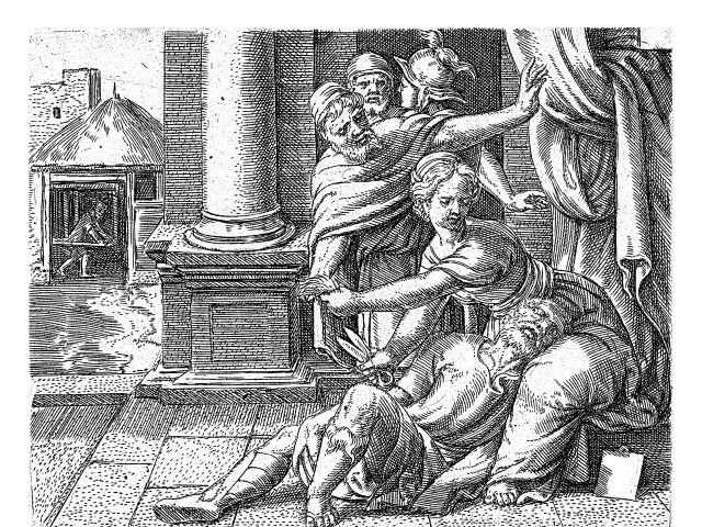 How long do hair transplant last